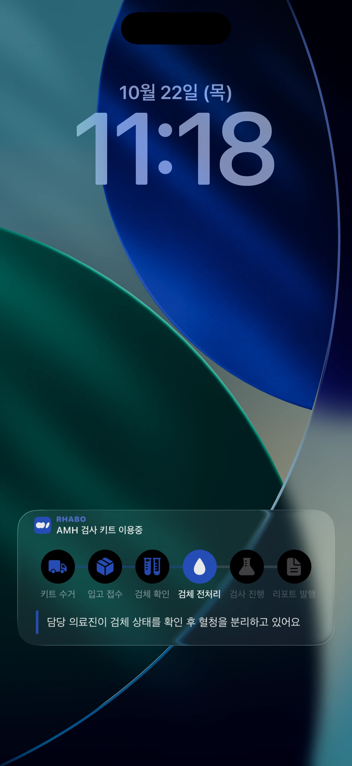 잠금화면 Live Activity: 검사 준비 중